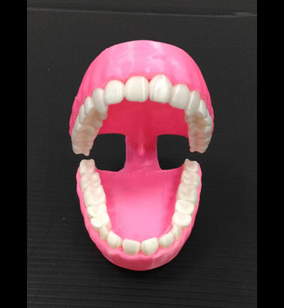 3D列印牙齒